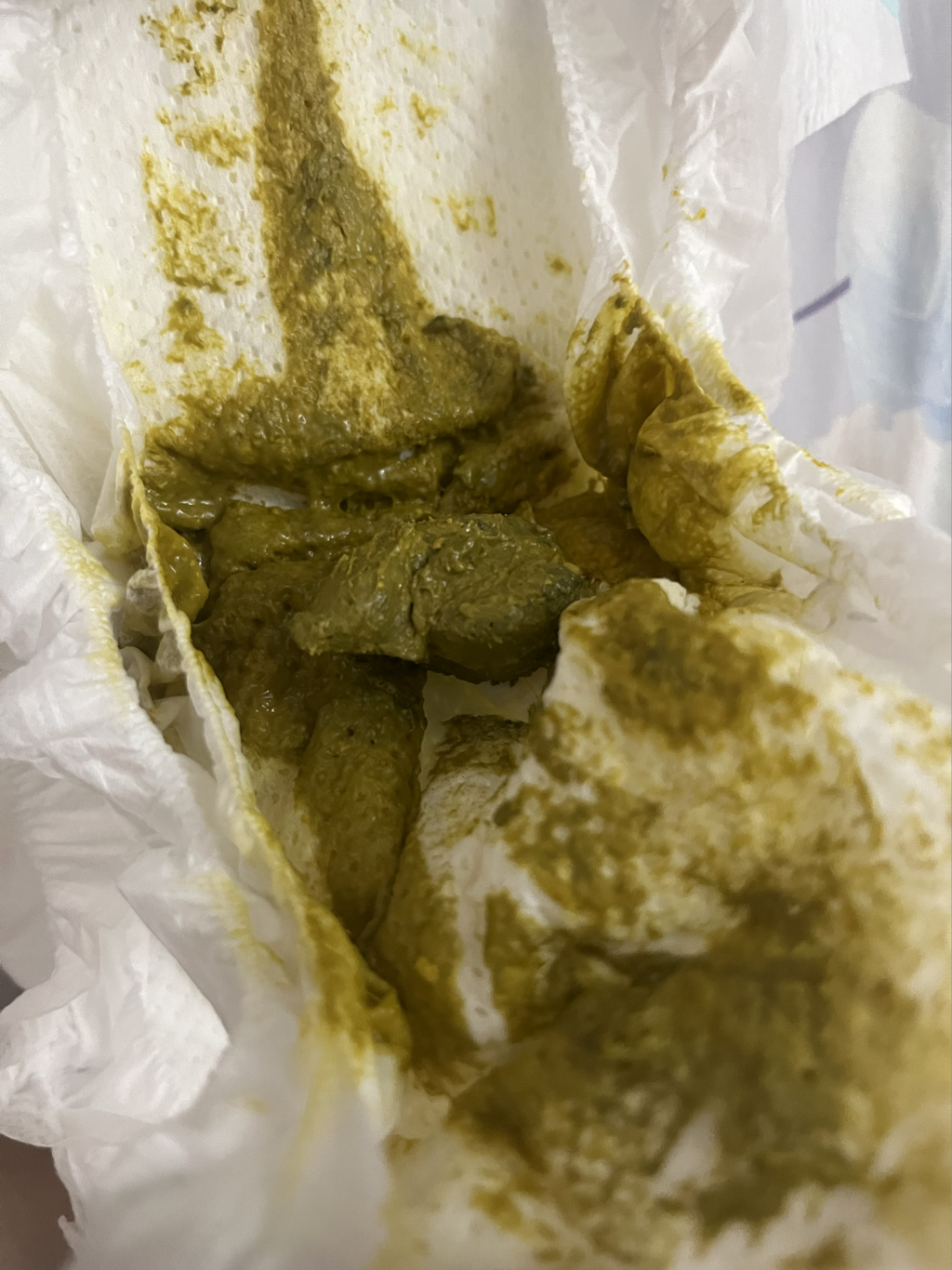 快三個月的寶寶大便長怎樣是正常的嗎