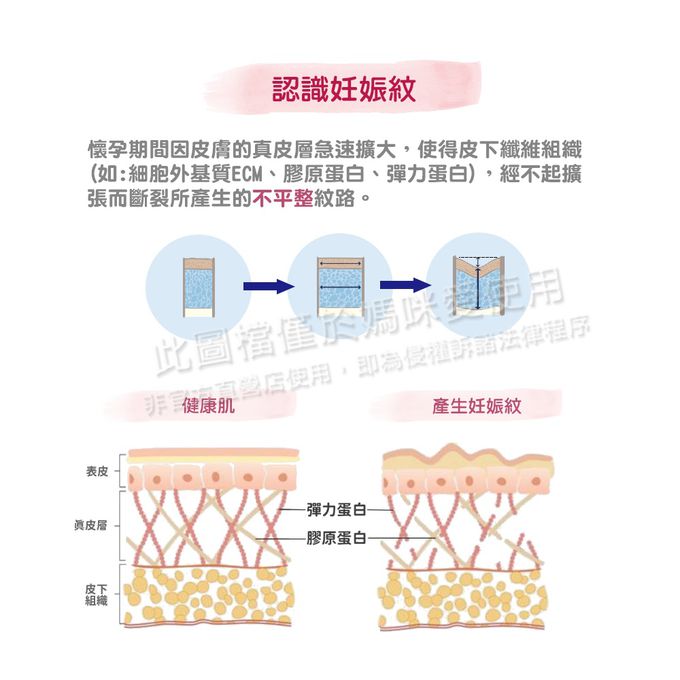 德國珊諾sanosan - S孕女神寵愛孕肌抗紋霜2入組-膠原彈力抗紋霜X2