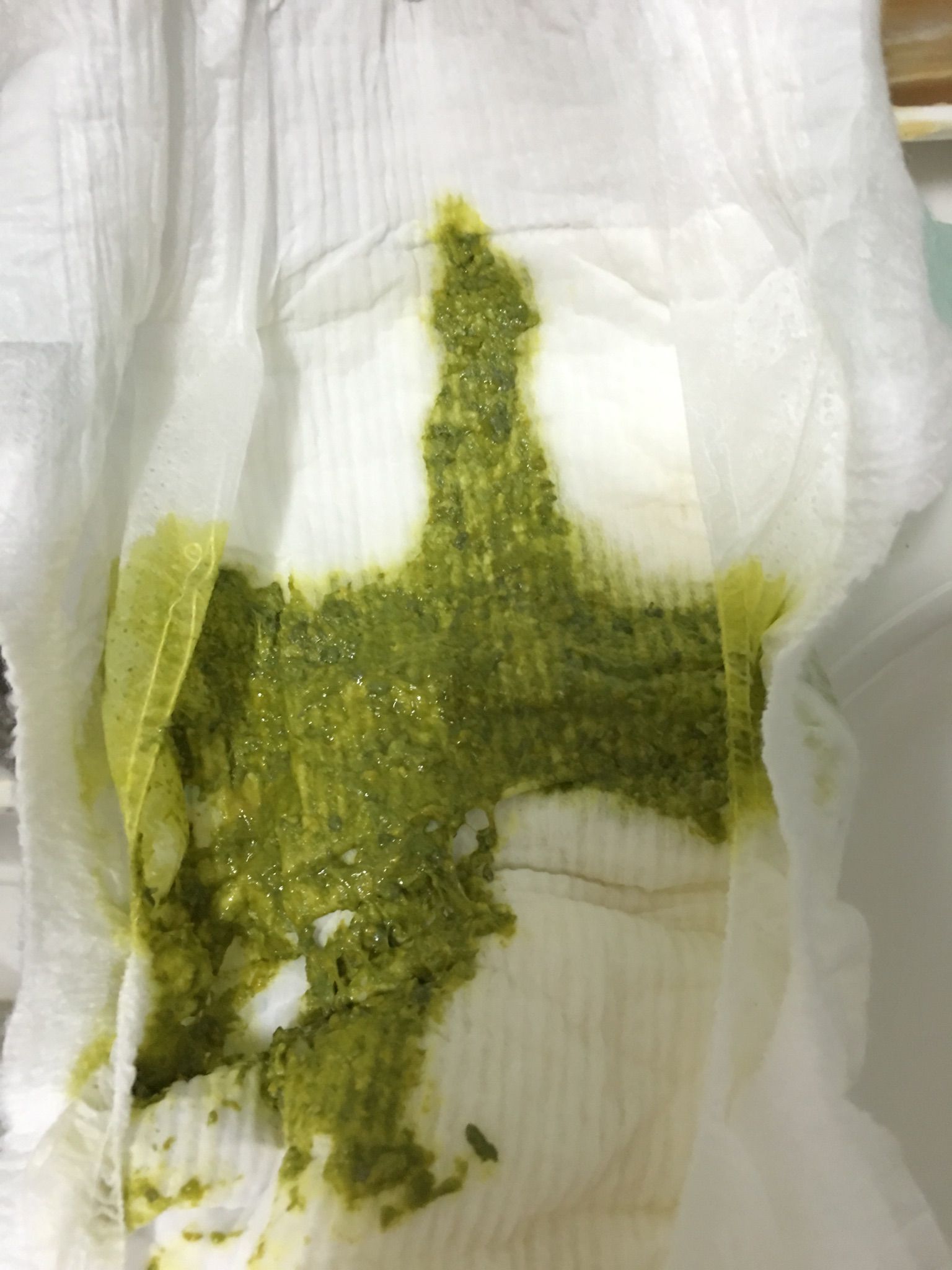 海苔綠便便正常嗎？