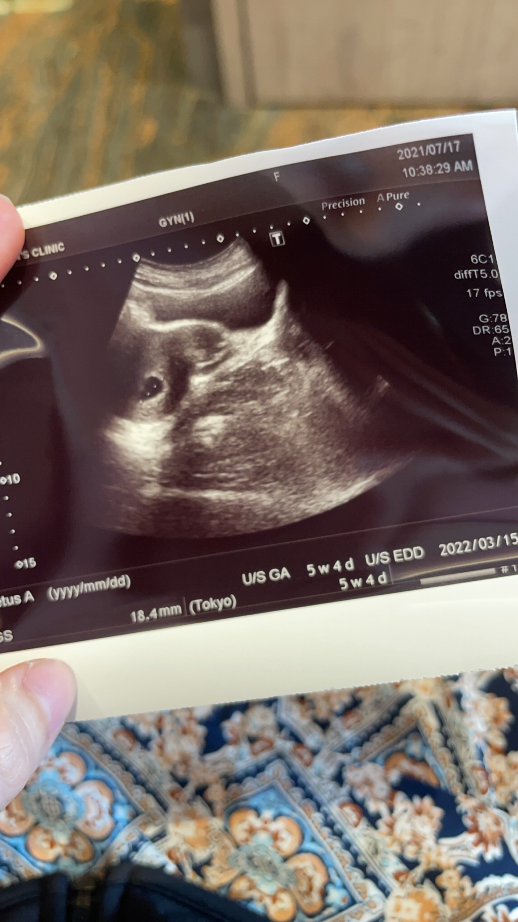 懇請介紹鳳山婦產科醫師?