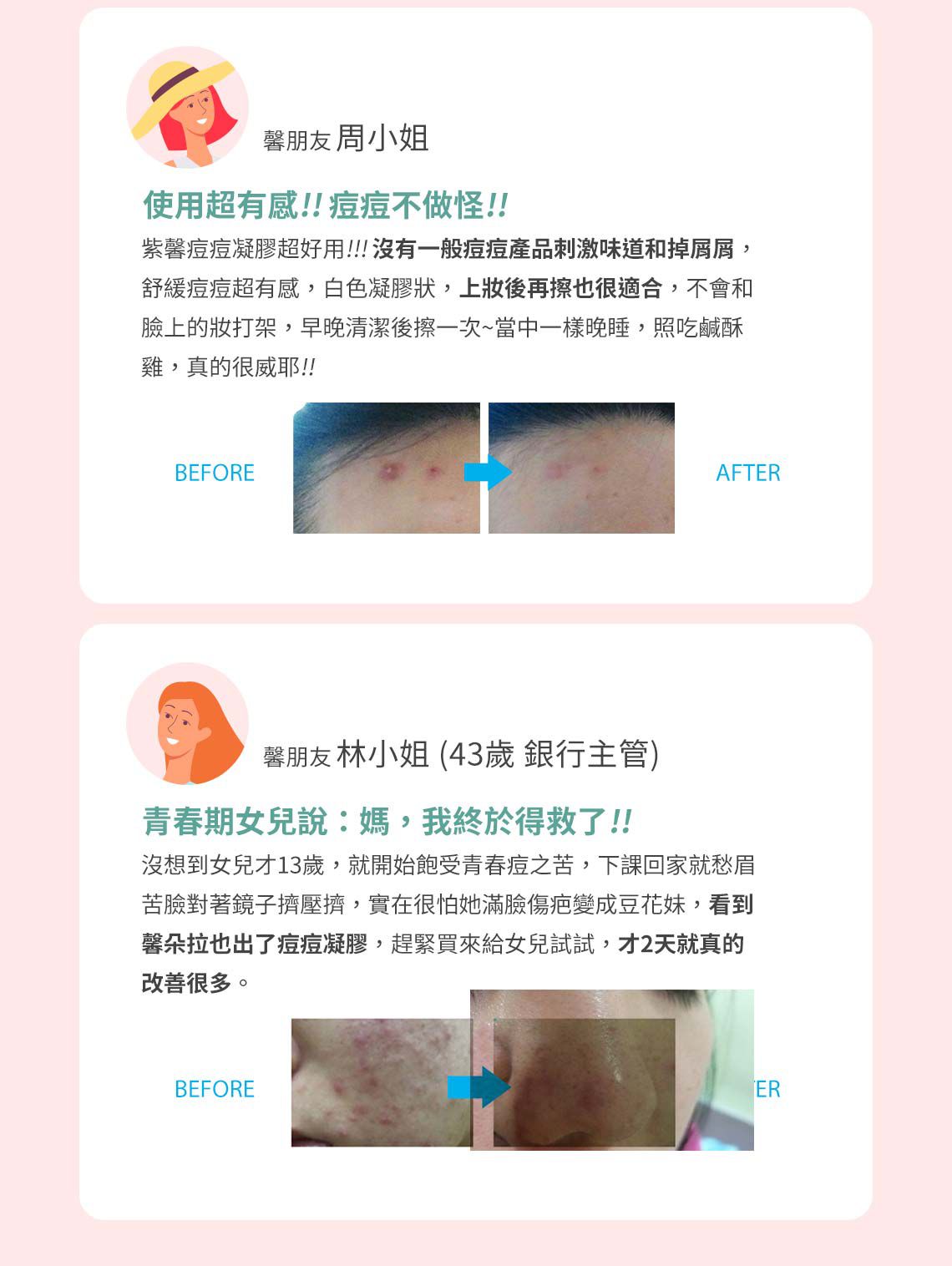 Cindora 馨朵拉 - 紫馨痘痘凝膠-10g