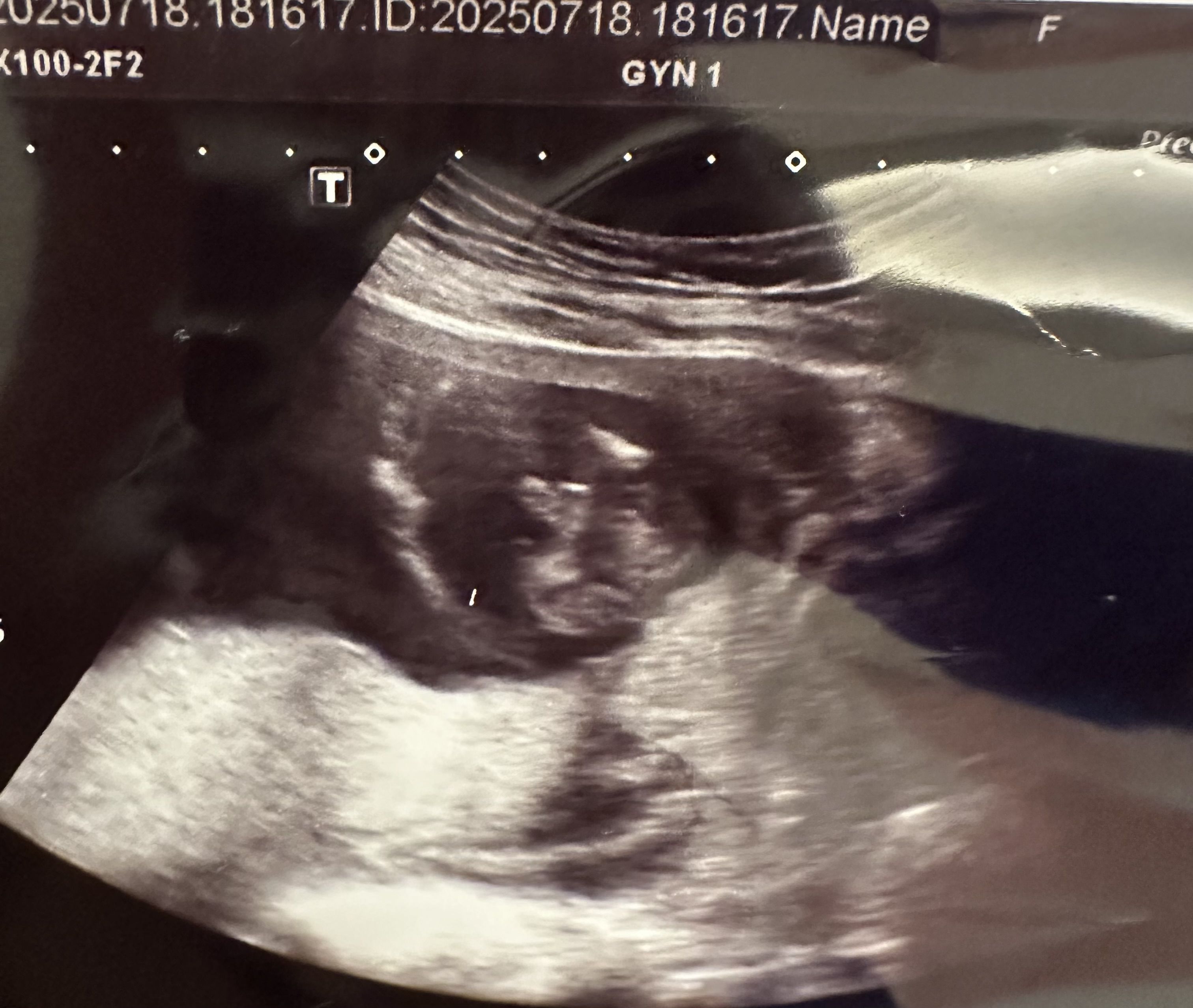 請問性別還會翻盤嗎？