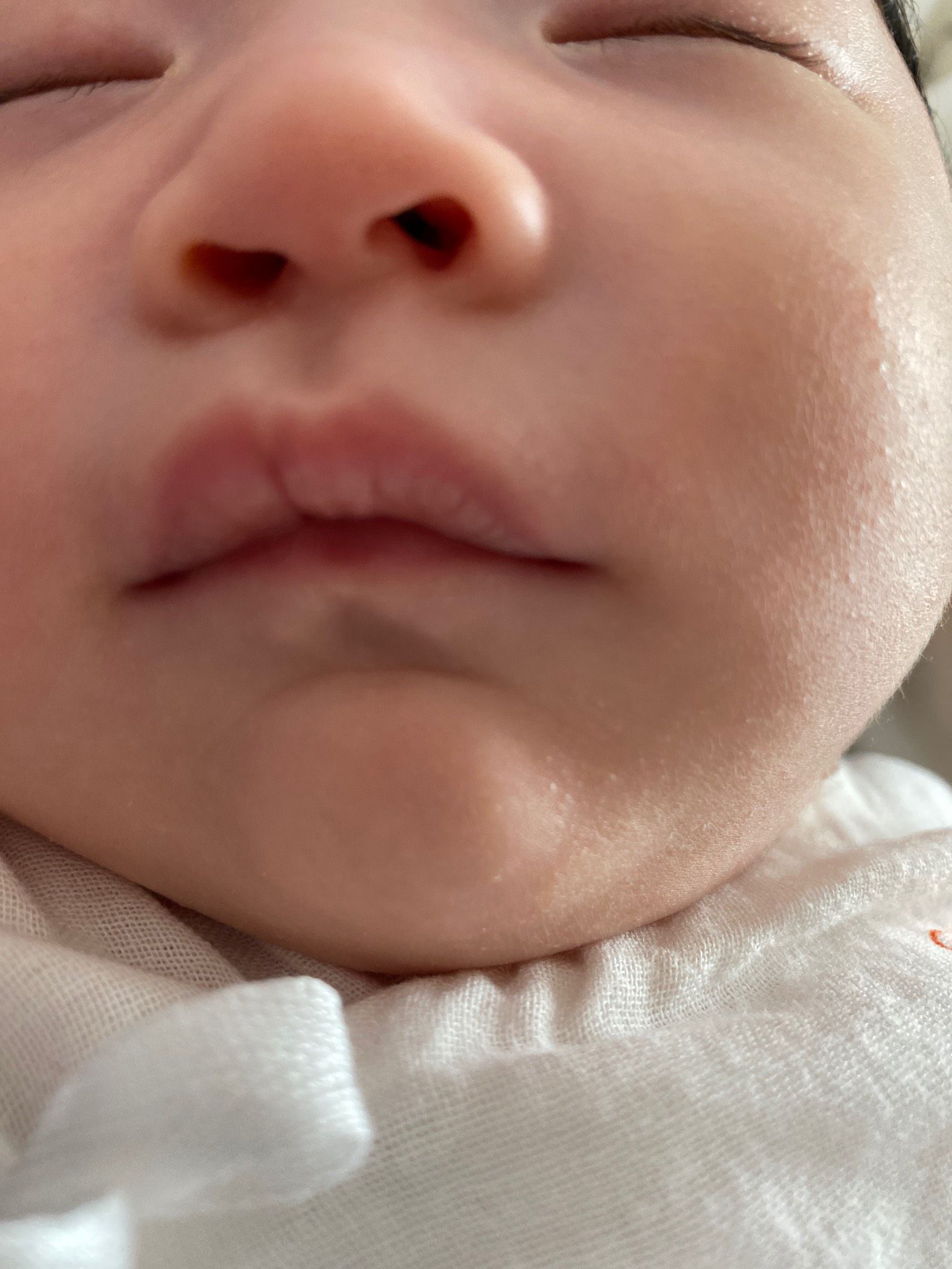 寶寶兩個月大，鼻子歪歪的，鼻孔不對稱