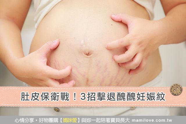 肚皮保衛戰！3招擊退醜醜妊娠紋