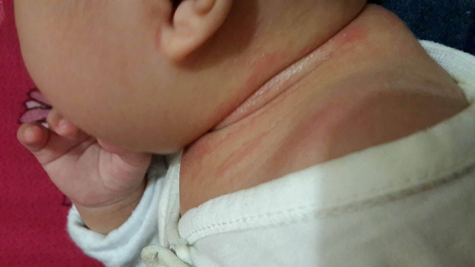 寶寶的脖子