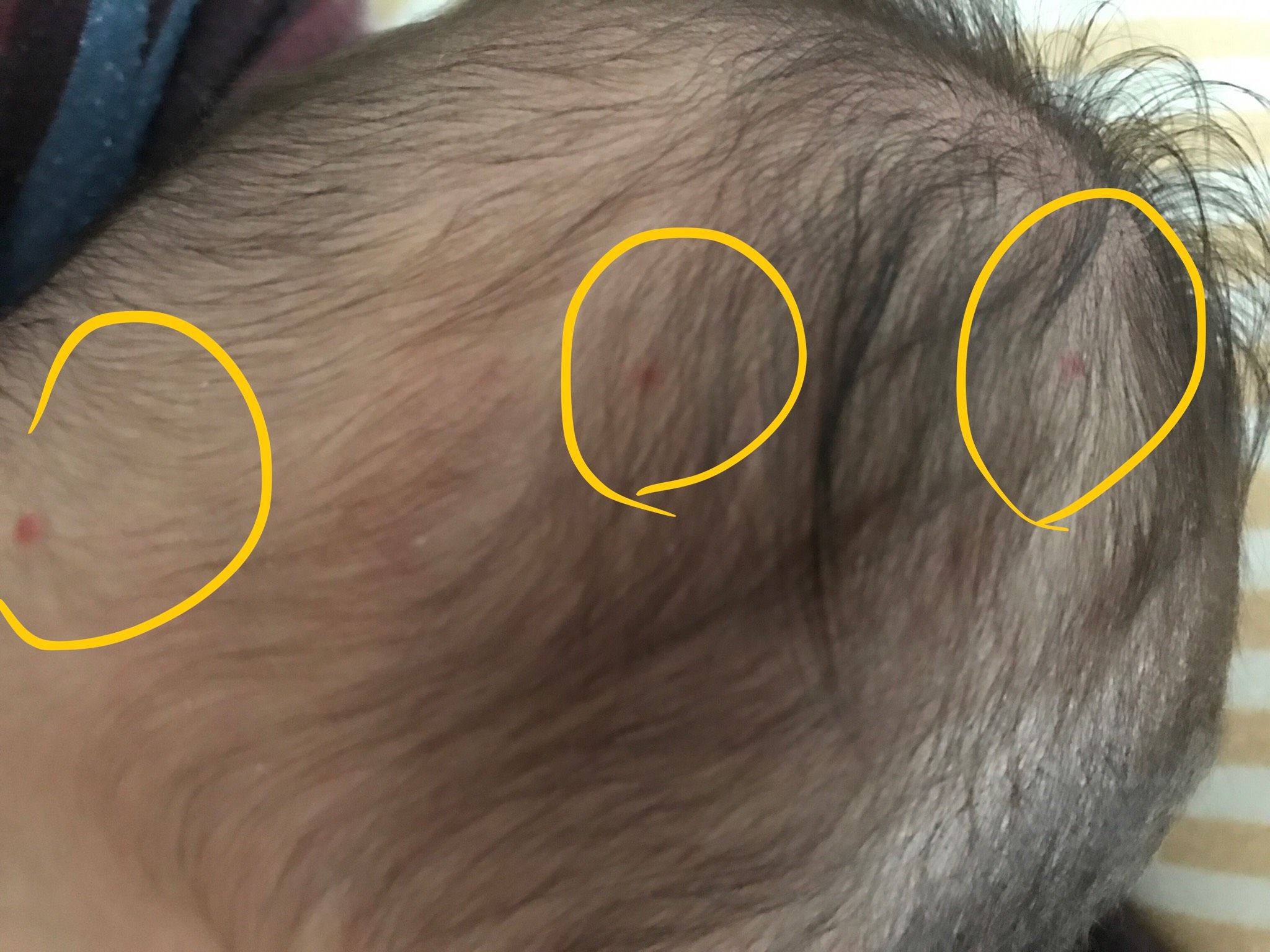 寶寶頭上一顆一顆紅紅的是什麼？