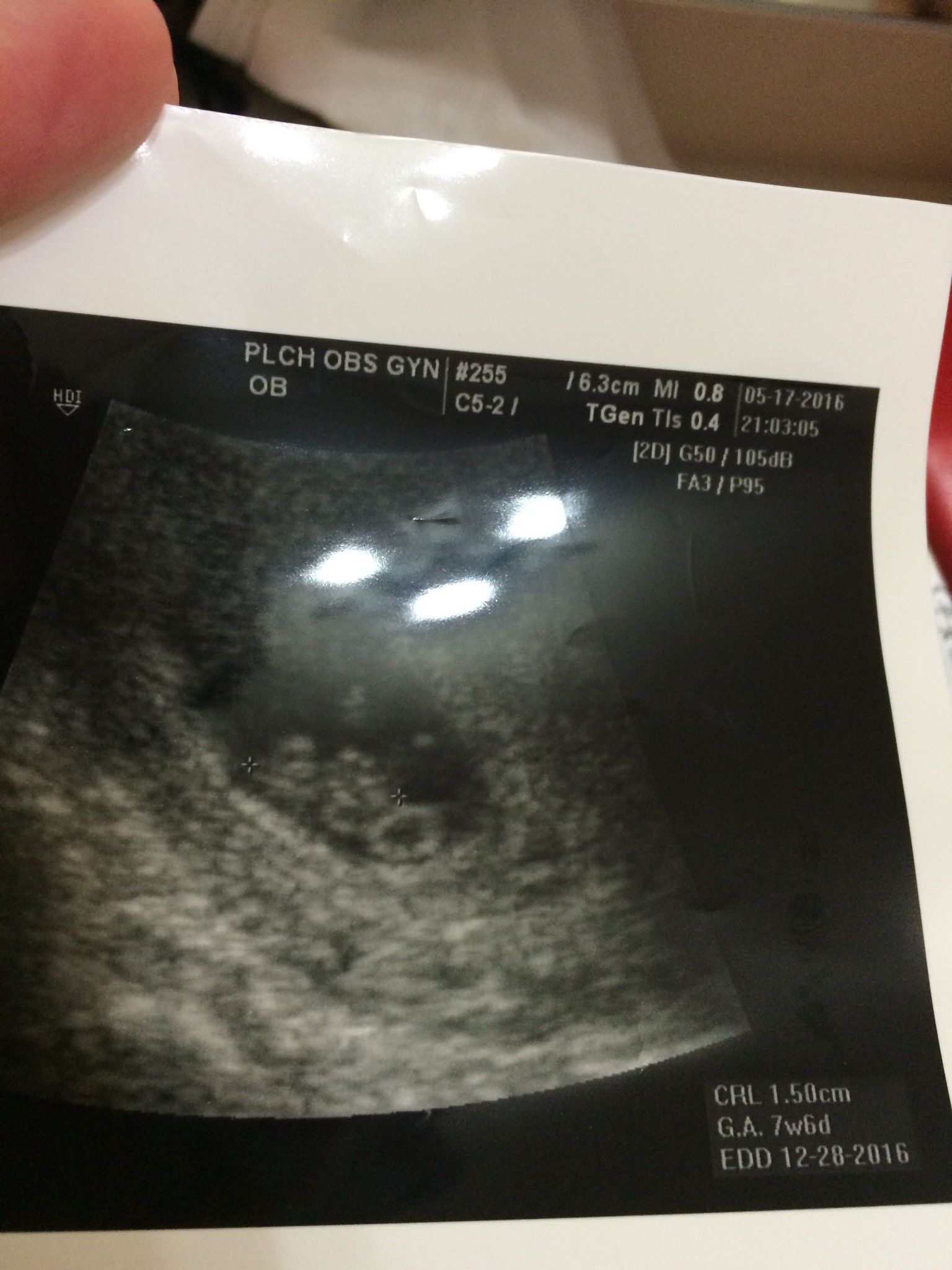 8週超音波 看的出來男女嗎