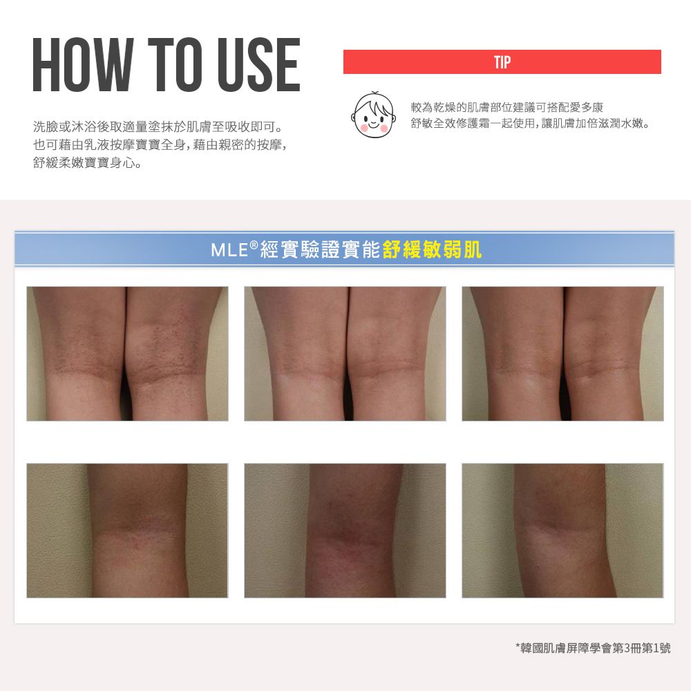 ATOPALM 愛多康 - [經典組] 加贈舒敏洗髮沐浴露-寶寶專用-20ml*1+全效修護乳液-20ml*1-全效修護霜-65ml*1+全效修護乳液-120ml*1