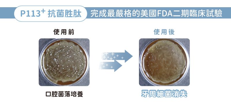 oh care 歐克威爾 - P113+抗菌胜肽 雙效兒童牙線棒-60入/盒