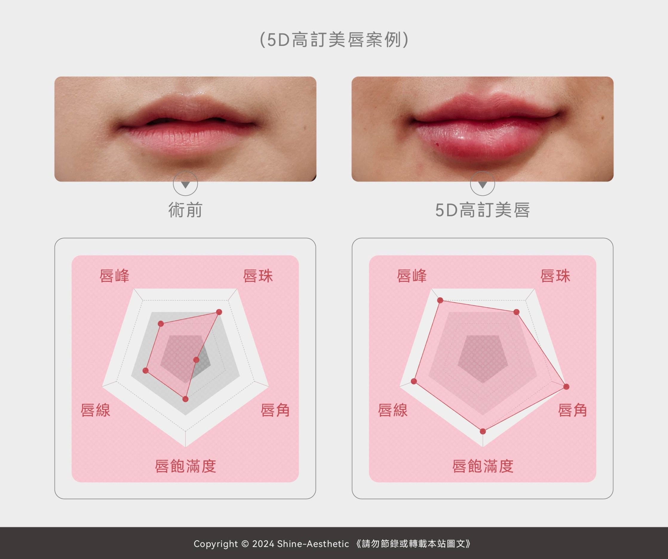 台北豐唇3間心得