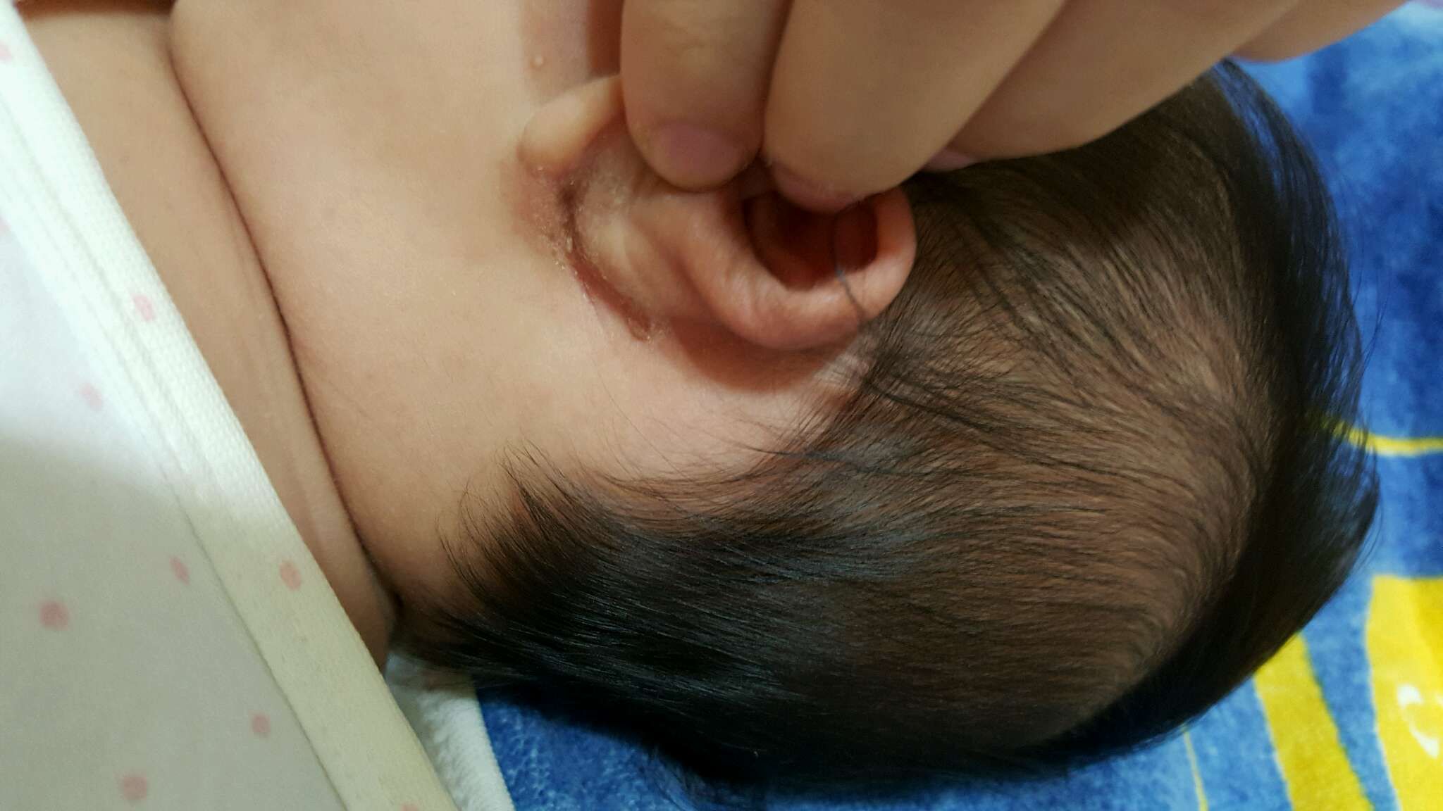 寶貝耳朵後面不知是髒還是？