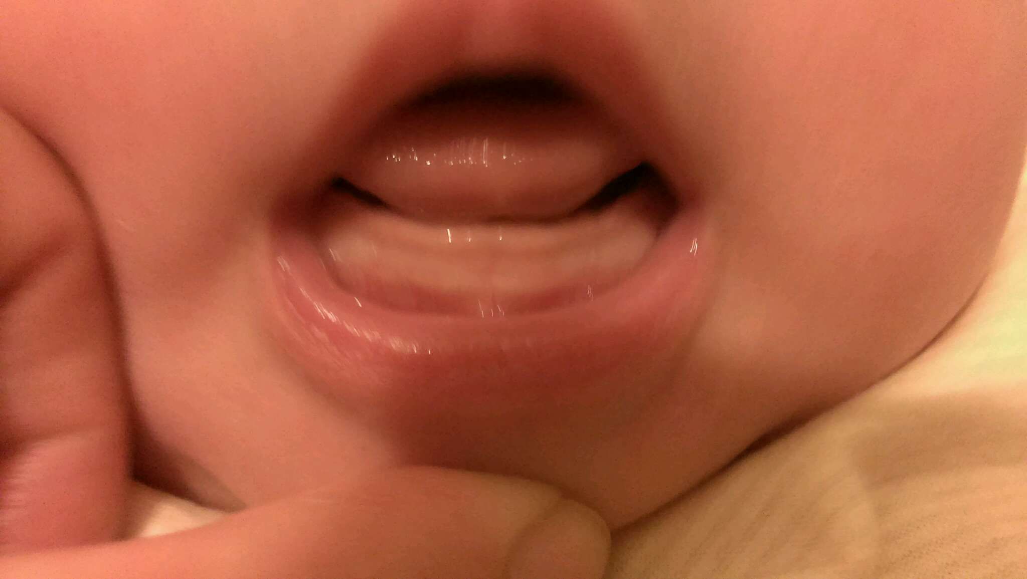 寶寶牙齦正常嗎？