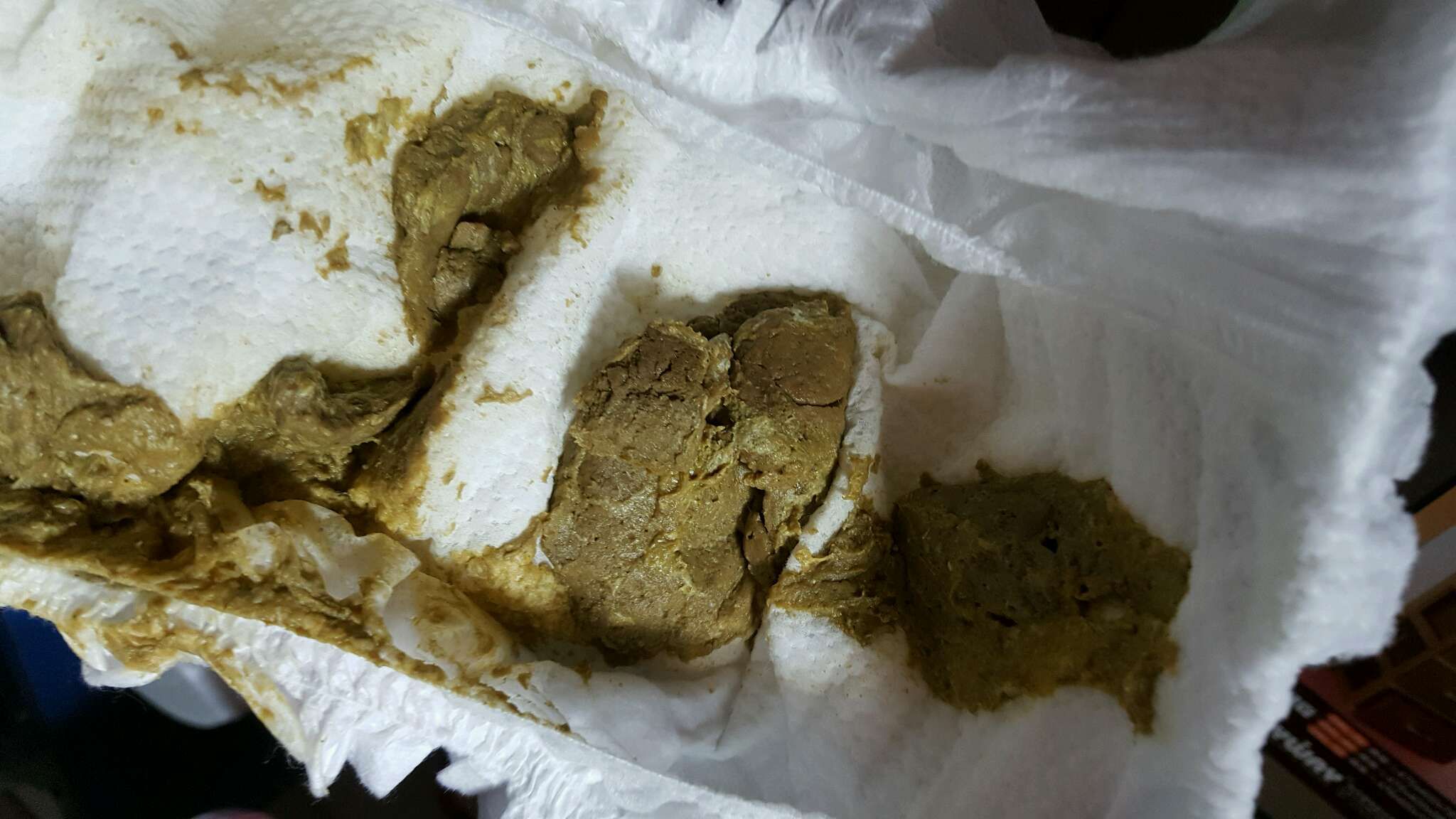 10個月大便正常嗎