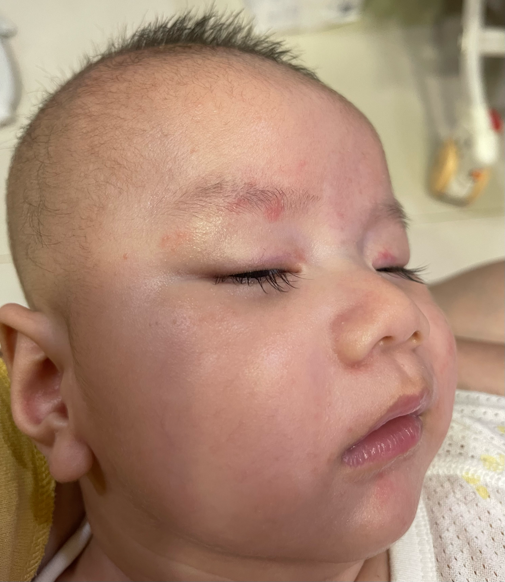 為什麼眼睛周圍會這樣