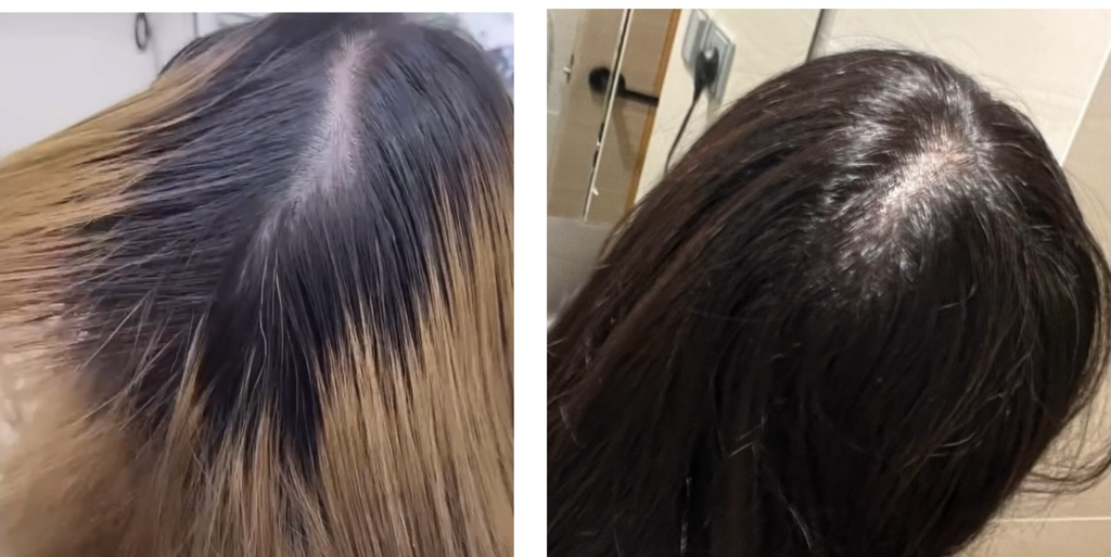 魔秘拯救了我令人崩潰的產後掉髮