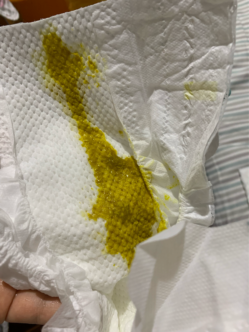 請問喝亞培親護大便稀稀水水是正常的嗎？