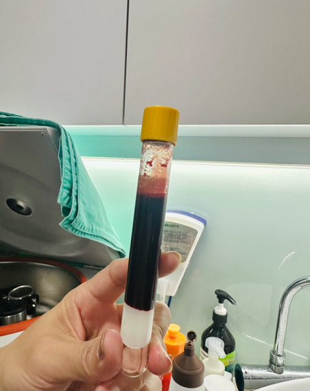 私密處乾澀影響婚姻(G緊雷射，PRP玻尿酸)