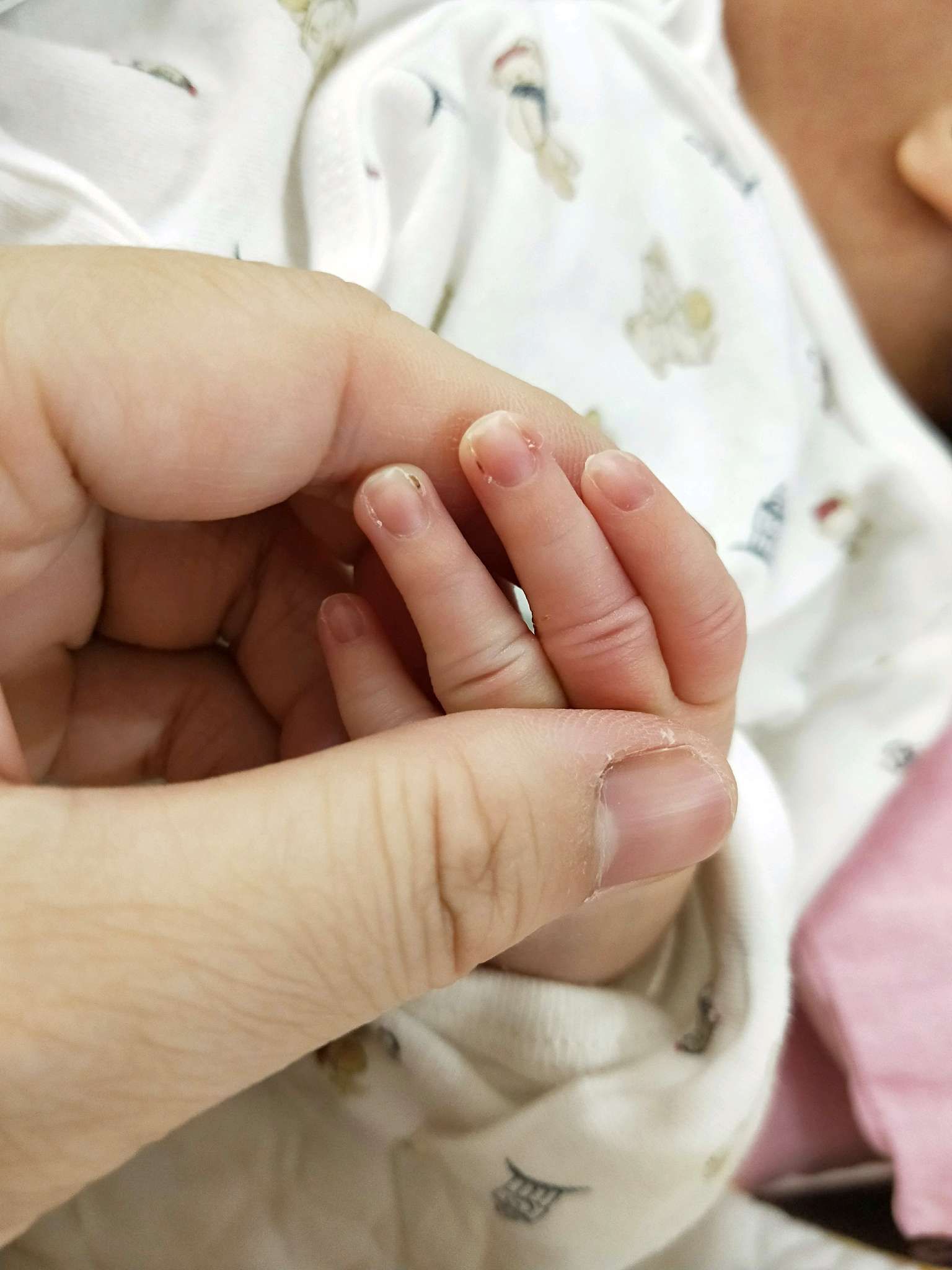 有人知道寶寶指甲邊緣怎麼了？