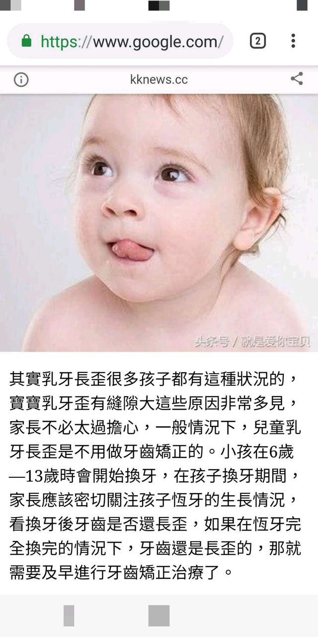 一般醫師通常都會建議換牙時再考慮矯正，樓上媽媽如果想去聽看看醫生建議也行