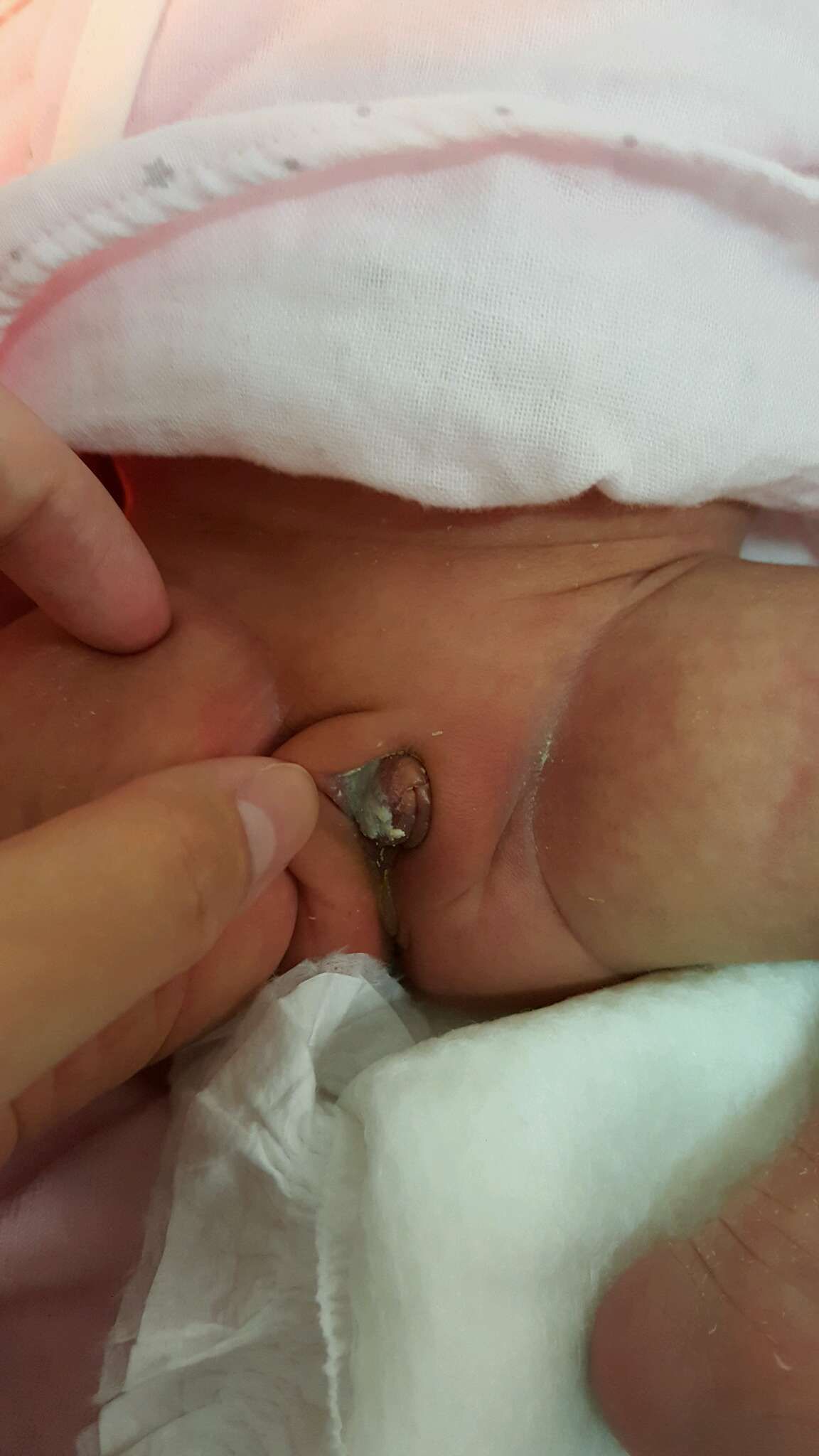 白色的分泌物是&hellip;&hellip;？