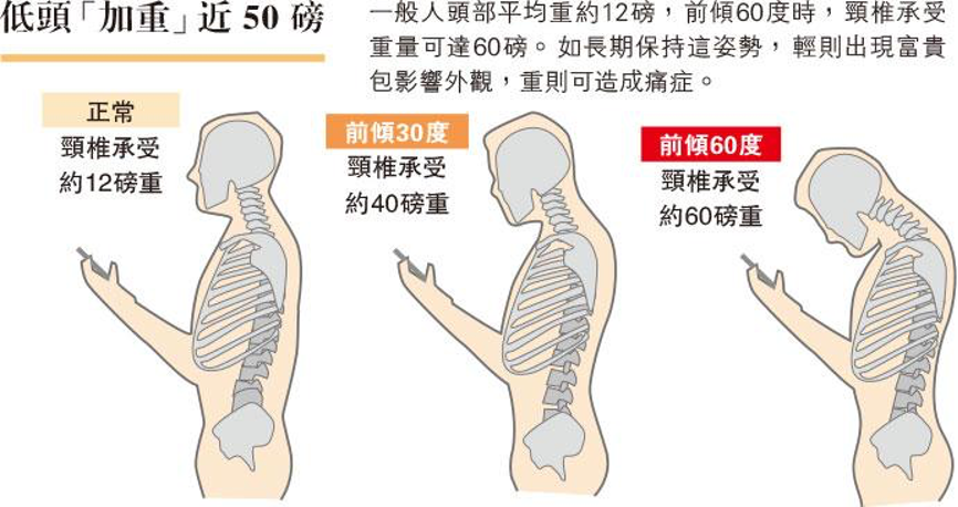 水牛肩打肉毒有用？