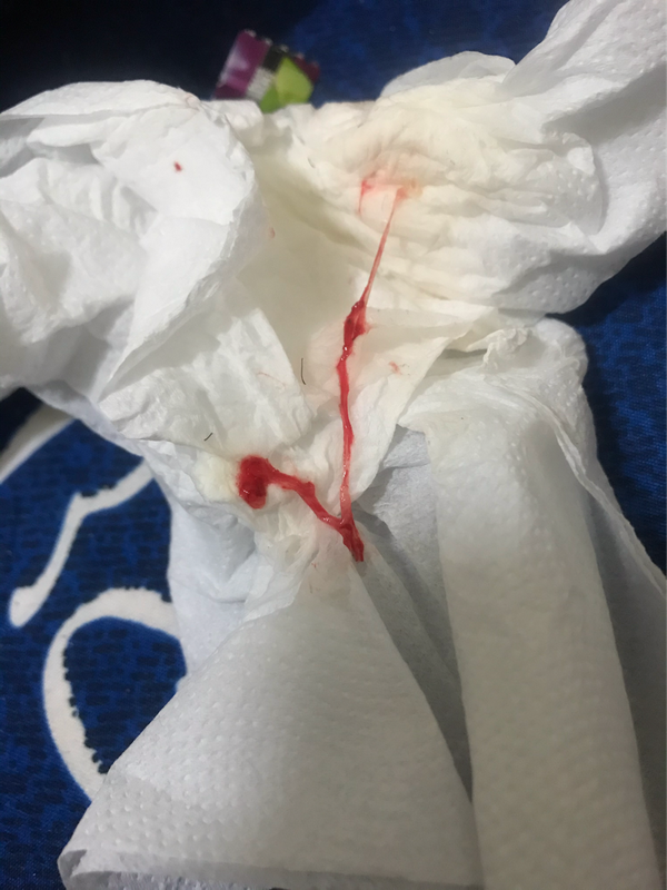 這是著床出血嗎 媽咪愛 育兒問答