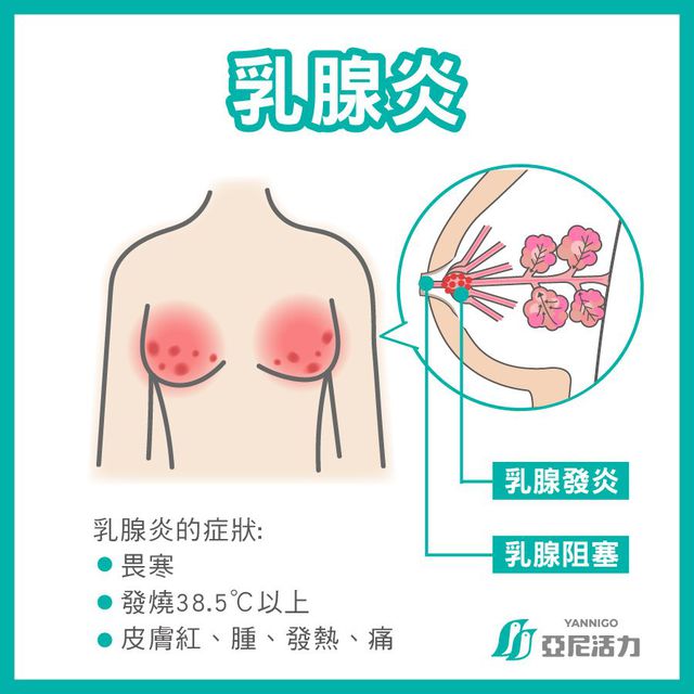 只要有發燒的症狀就是乳腺炎了哦！如果超過24小時的話建議媽咪快去看醫生哦~