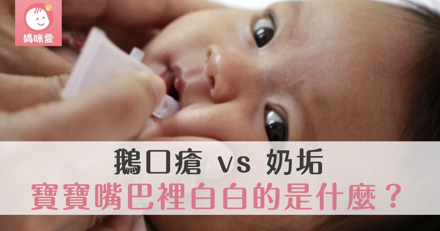 鵝口瘡 vs 奶垢｜寶寶嘴巴裡白白的是什麼？