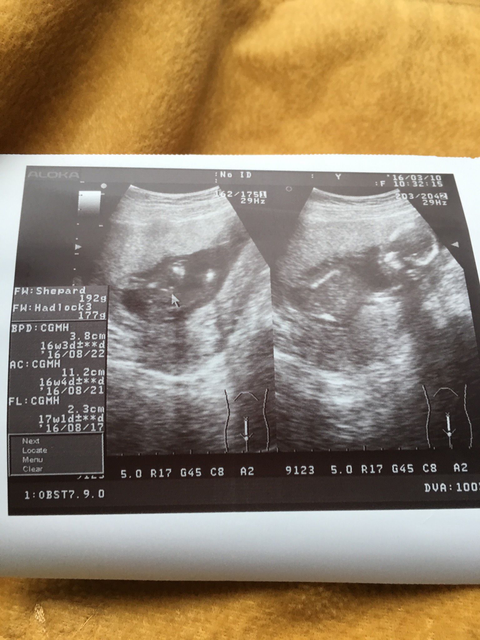 16週超音波 男寶寶還是女寶寶