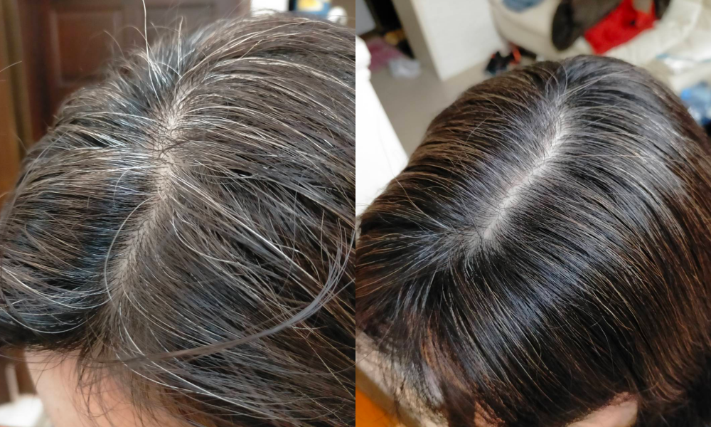 最高現折$600!!【髮速黑｜美吾髮植優】孕婦哺乳可用