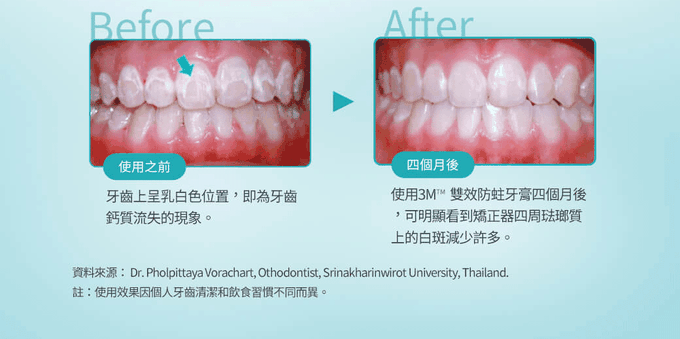 美國 3M - 【3入組】雙效防蛀護齒牙膏