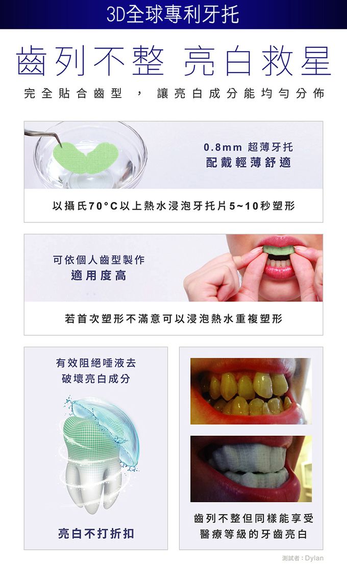 普麗斯 - 3D牙托式深層牙齒美白長效組(5-7天)