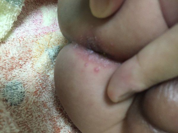 屁股長白白和紅點點