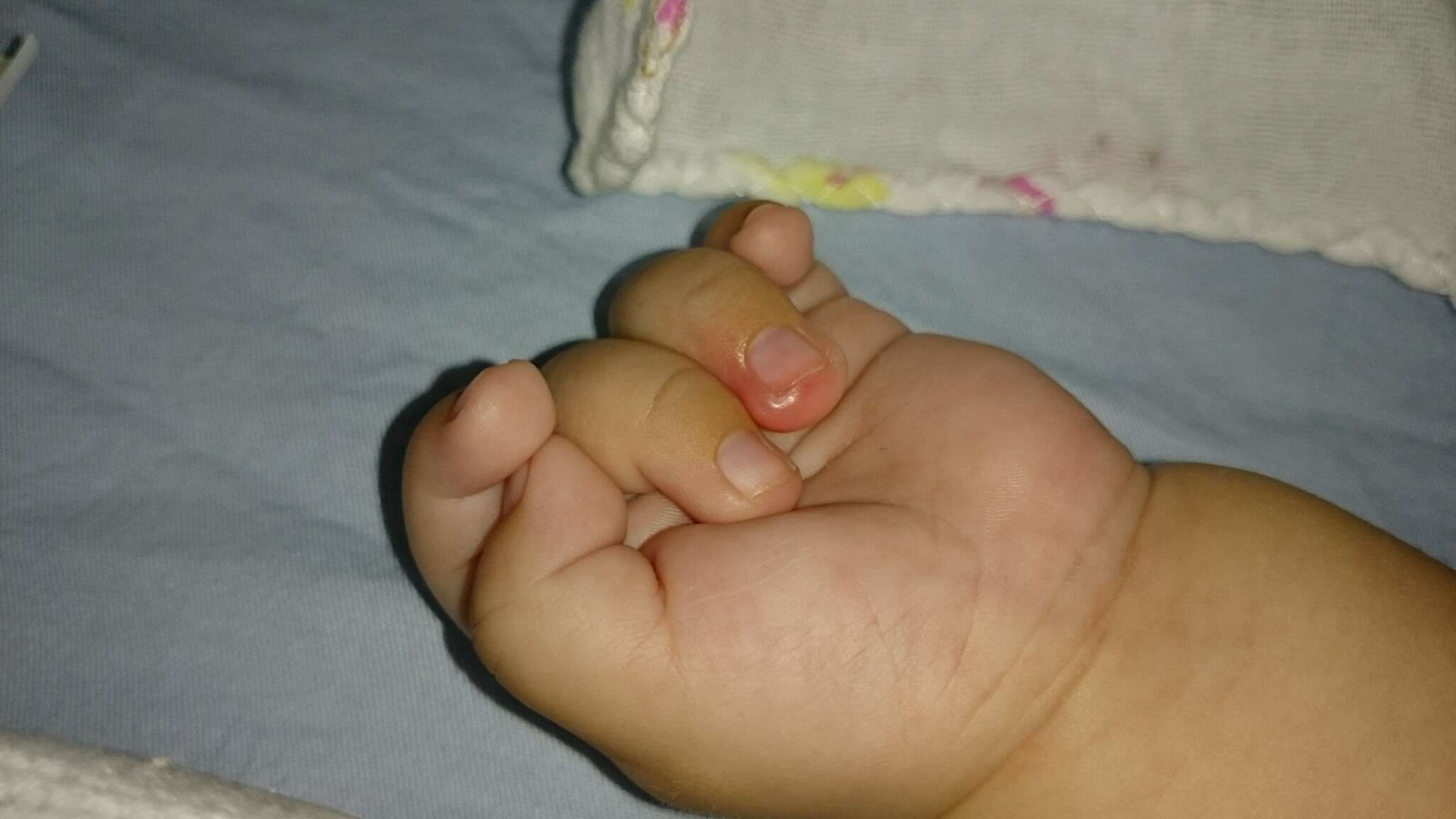 這是剪太短嗎 ？