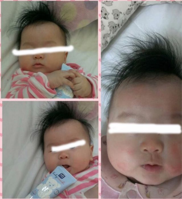 FB 蠻多麻麻分享寶貝可可麗的護膚霜的⋯也有看到寶寶臉部其他疹子問題～ 可以參考看看喔 https://www.facebook.com/babycoccoleTW?ref=hl
