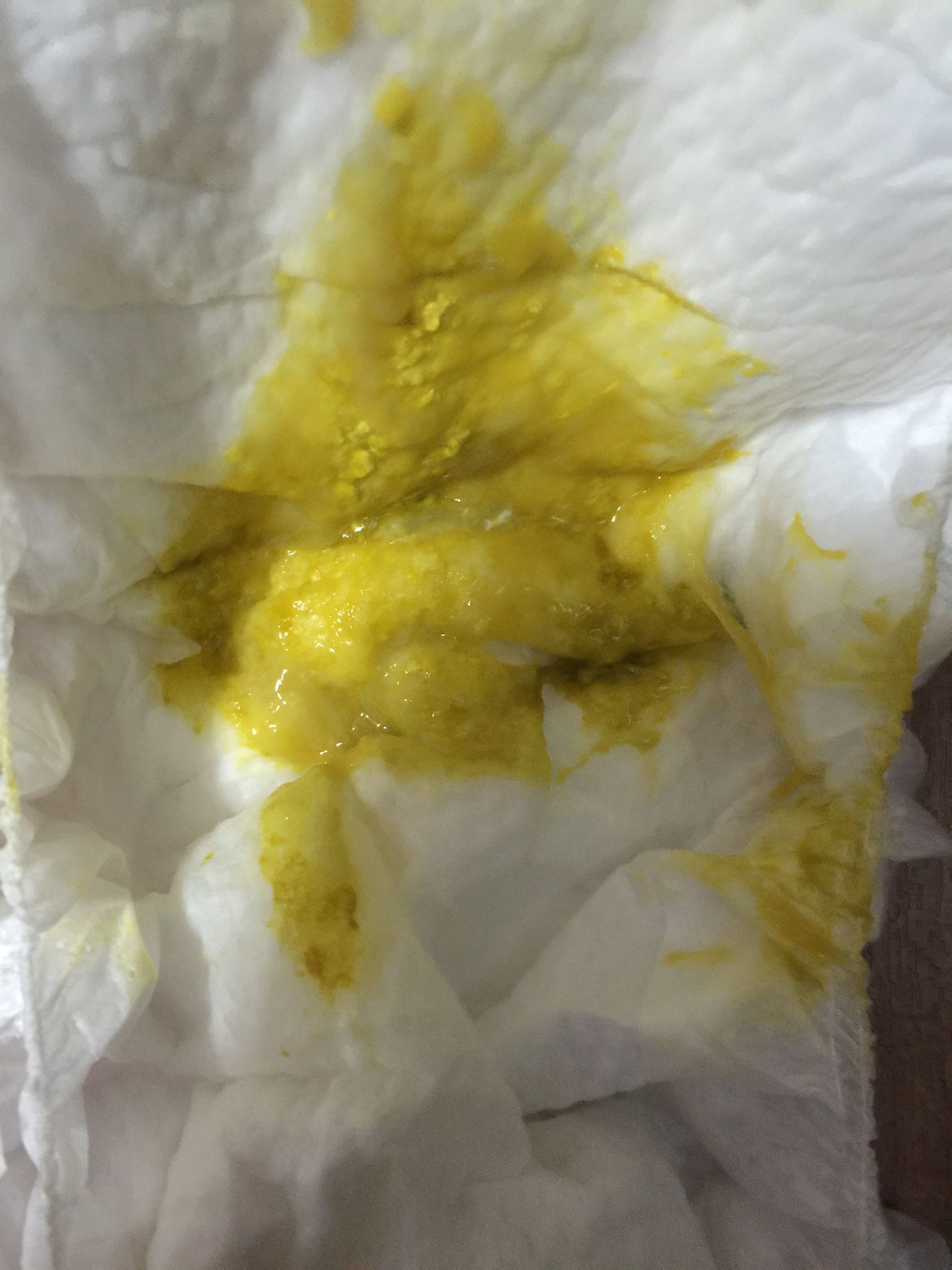 4m18d寶寶大便4次，純母奶哺餵