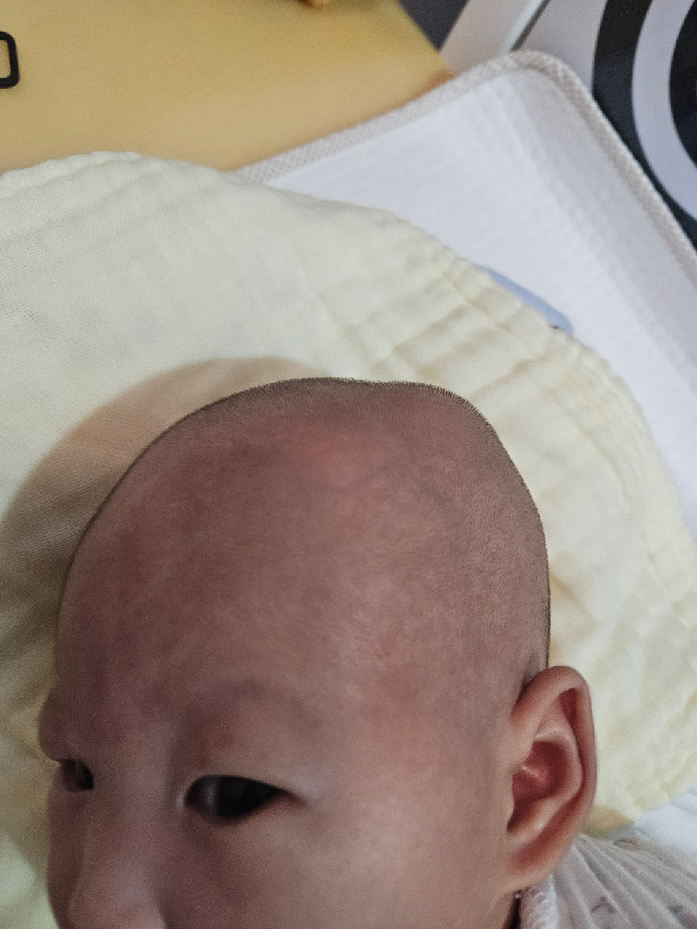 寶寶頭型很畸形