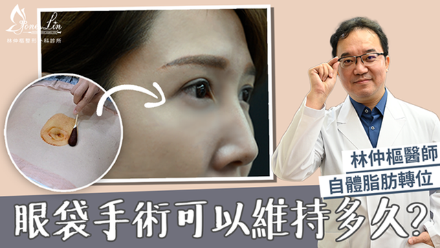台北大安區林仲樞醫師~
之前給他做眼袋內開+補脂效果超好
後來也帶我媽一起去做
整個氣色變好很多
而且他們診所還有高壓氧艙可以修復術後傷口
林醫師有拍影片解說，可以參考一下
https://youtu.be/3xNQTvTWPqk