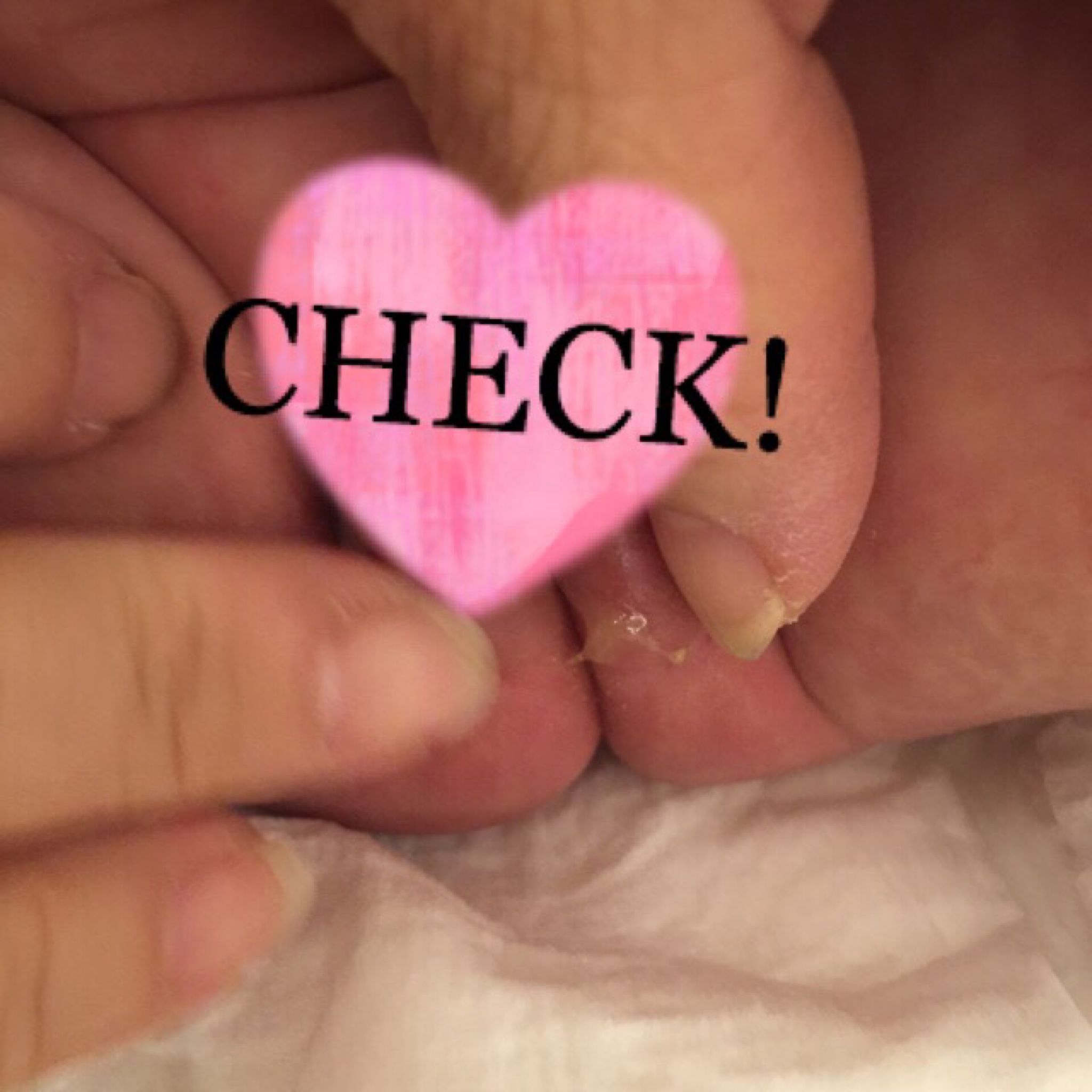 女寶寶陰道分泌物