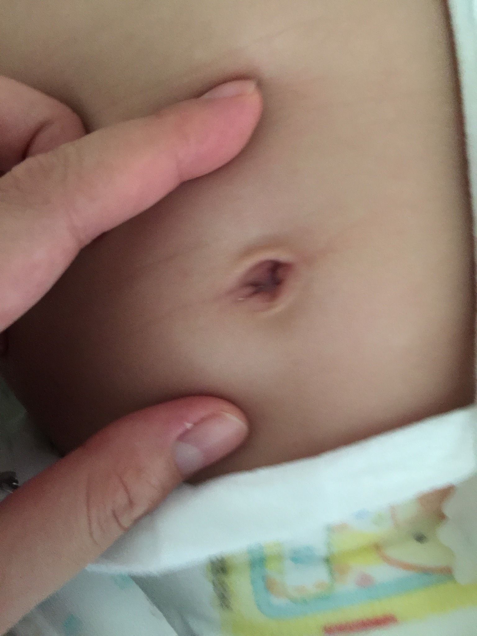 3M寶肚臍紅紅的