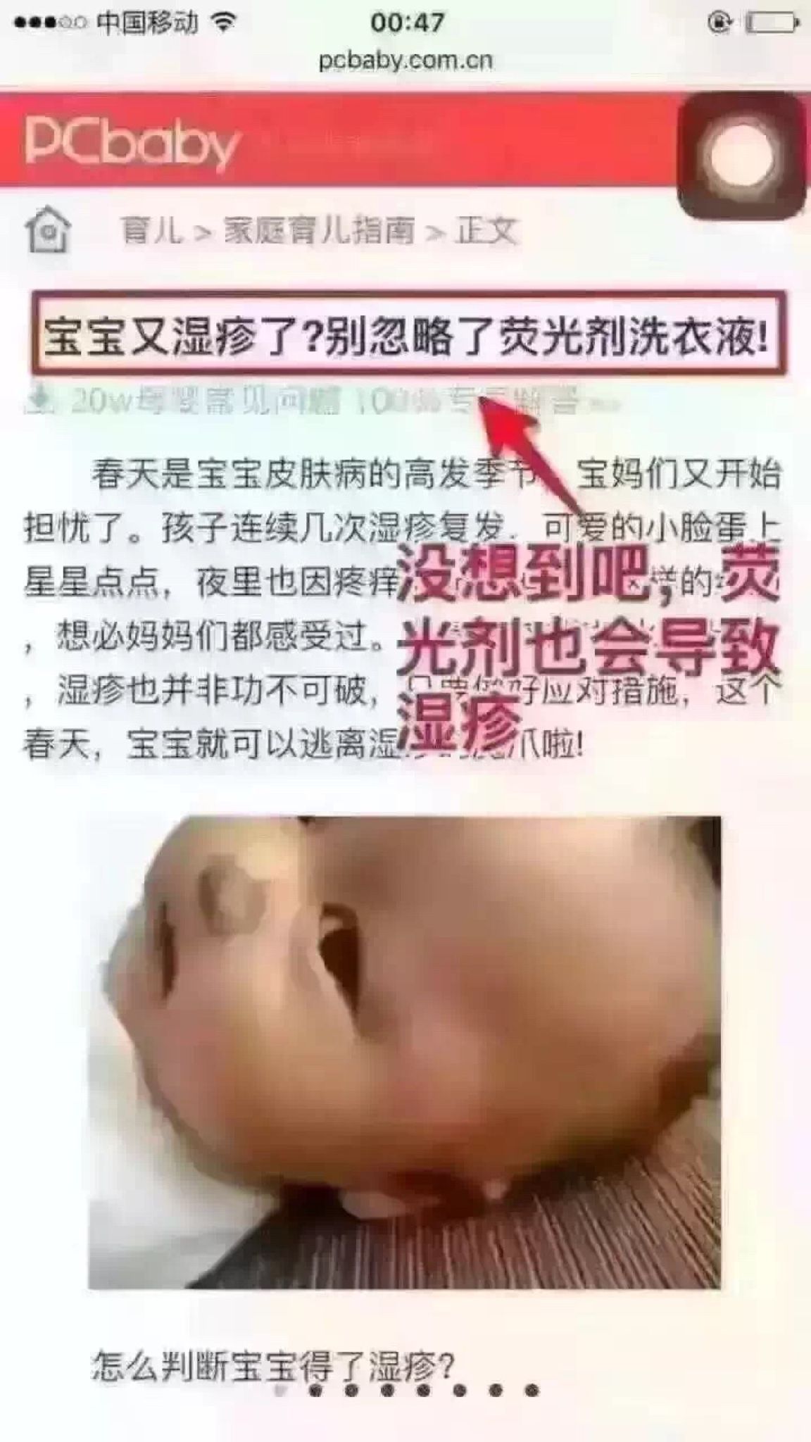 宝宝的湿疹是有荧光剂造成的