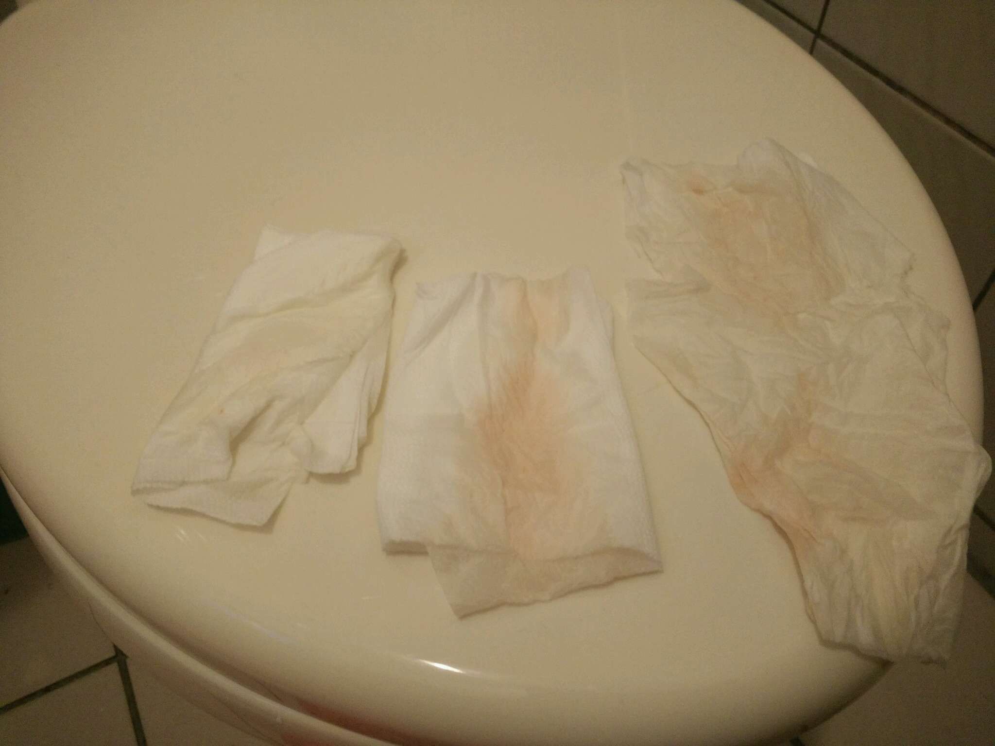 這是破水 + 微微落紅嗎？