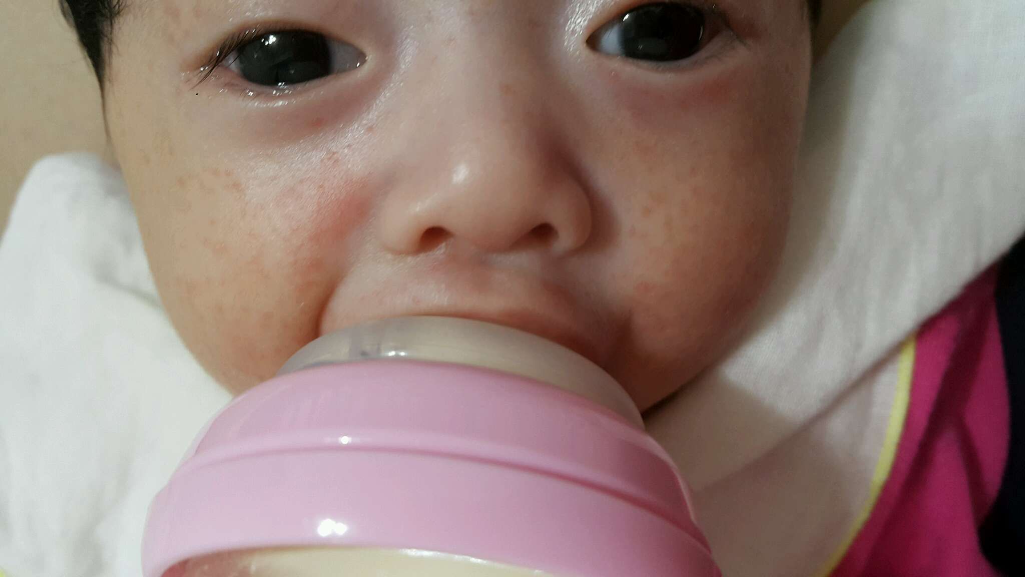 臉上長疹子