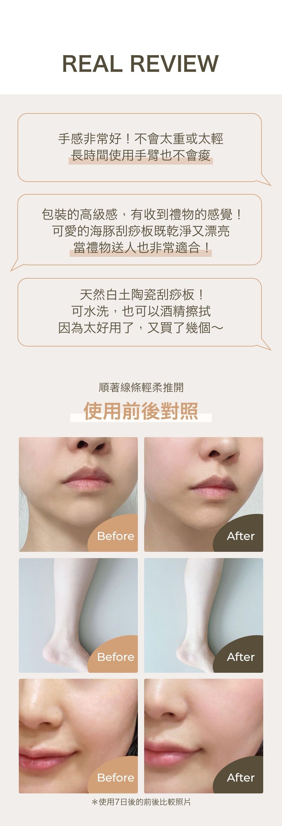 韓國 EDVIEW - 全身適用手工舒壓陶瓷刮痧板-白色海豚-1入-直播專屬