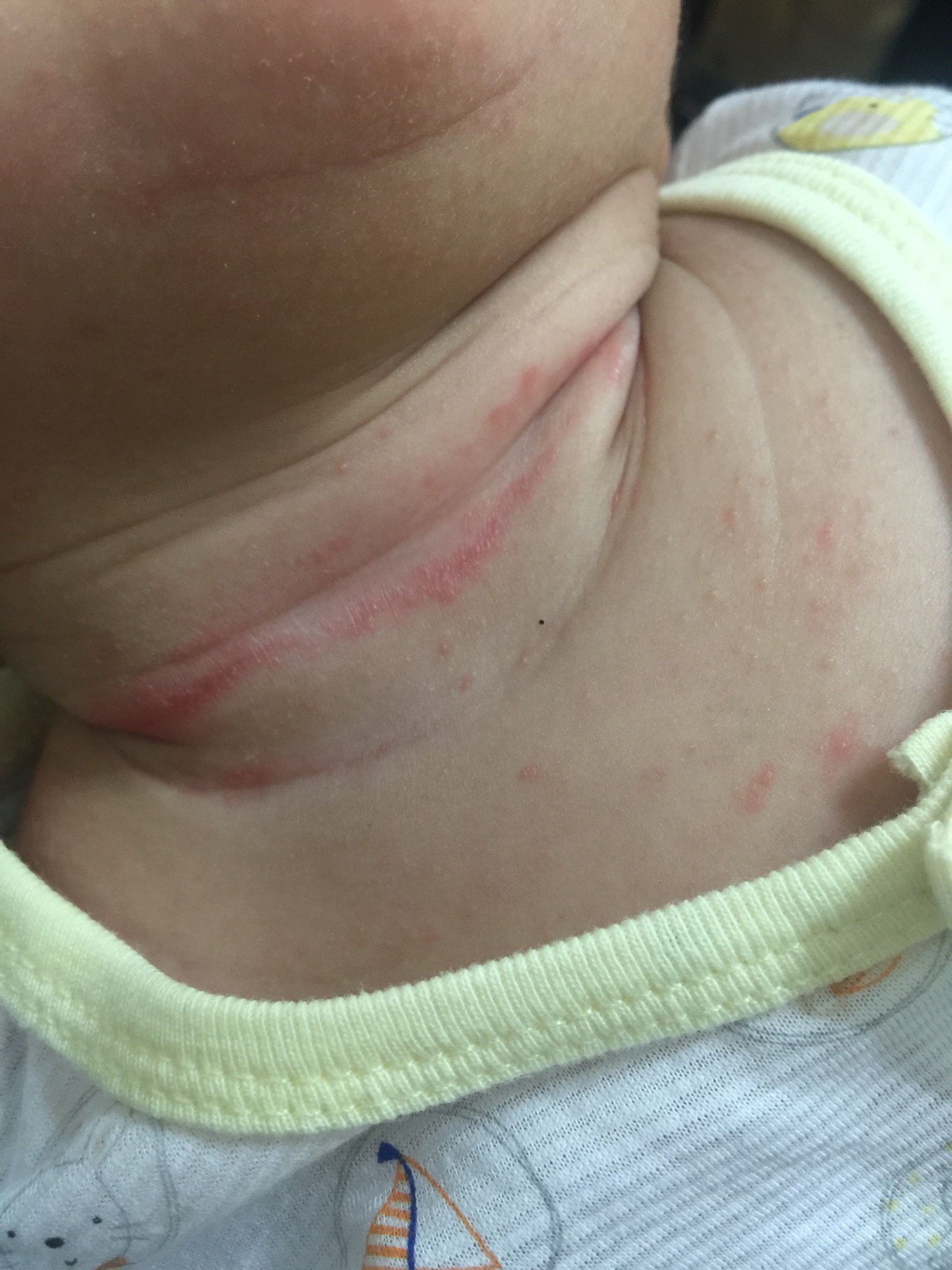 脖子肉摺紅紅的