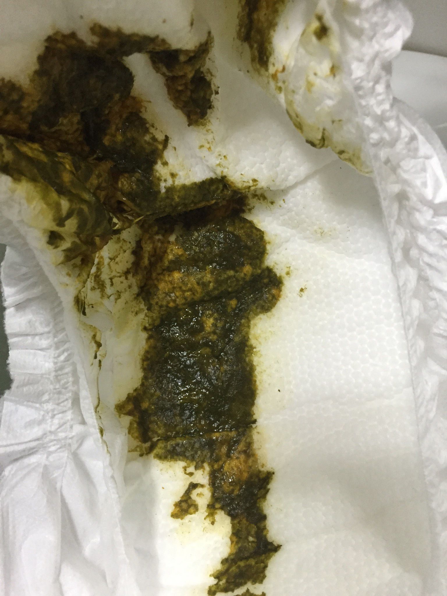 寶寶拉肚子（照片是便便照，有點噁）