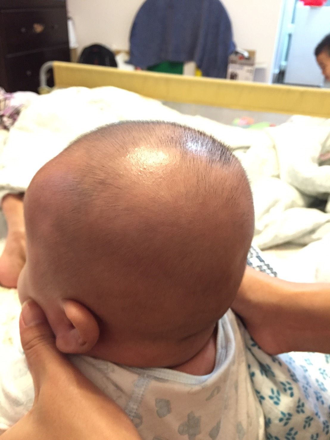 寶寶三個月，後腦有點凹凹的