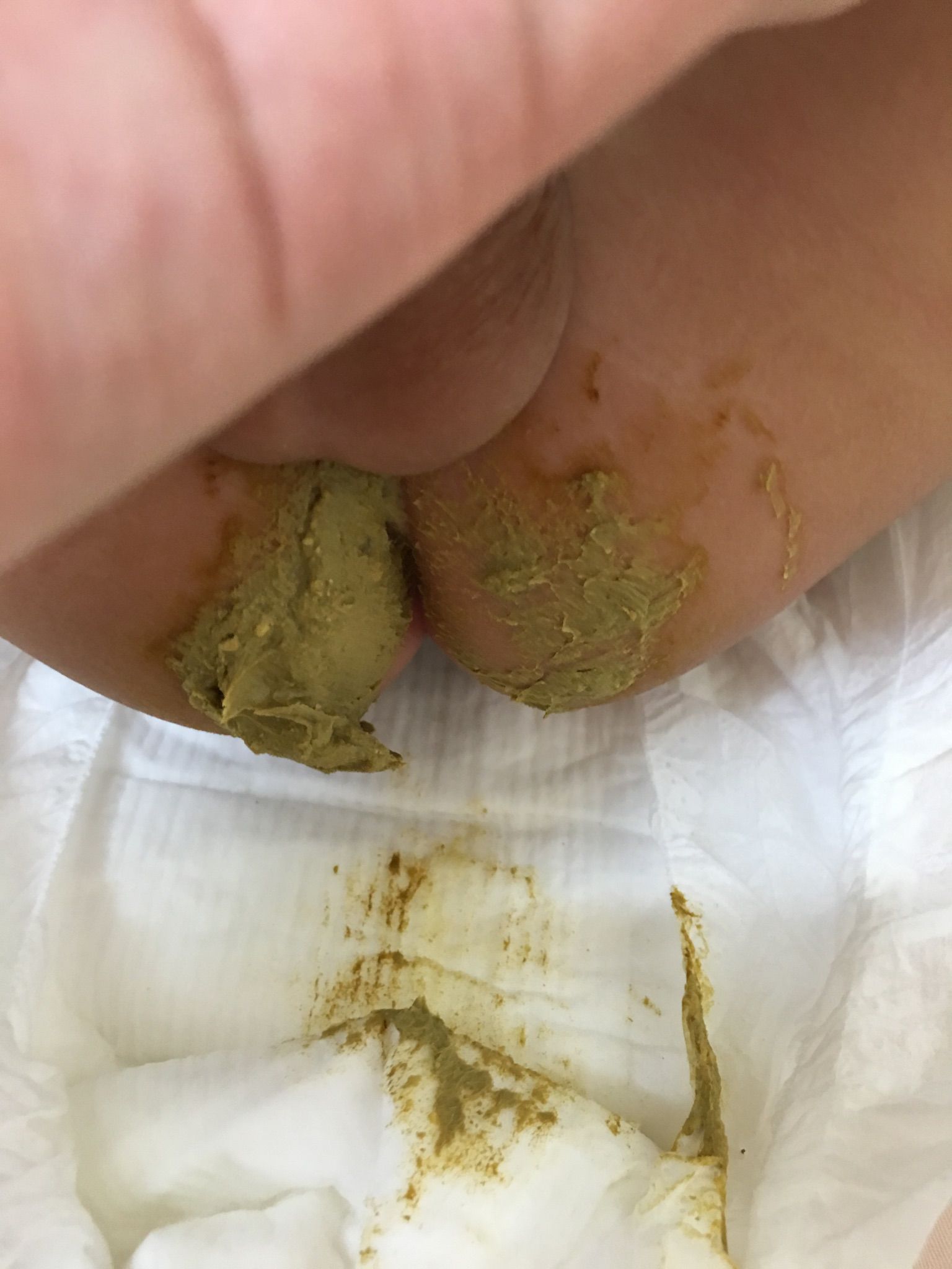 寶寶這樣大便算正常嗎？