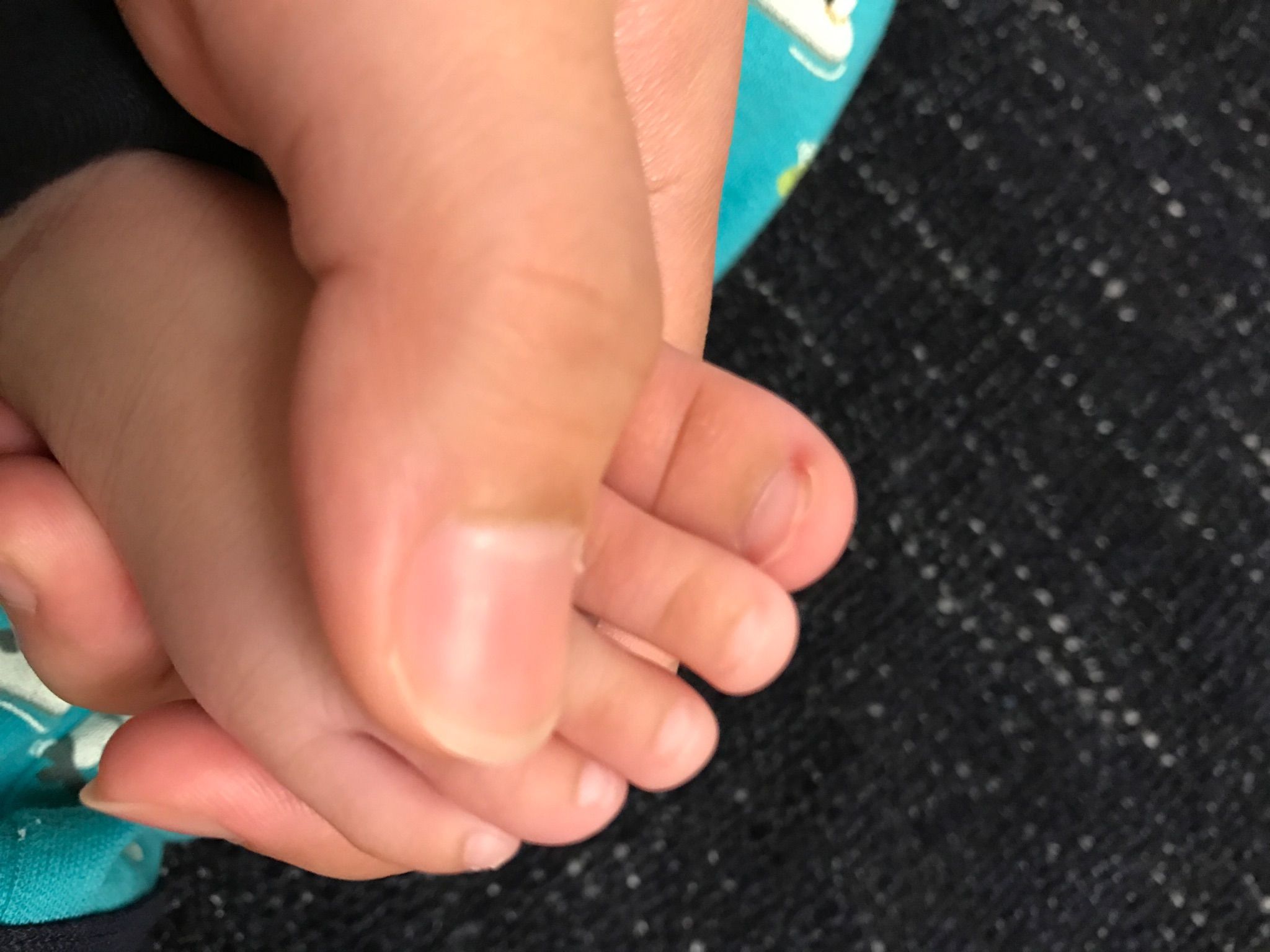 寶寶的腳指甲怎麼剪