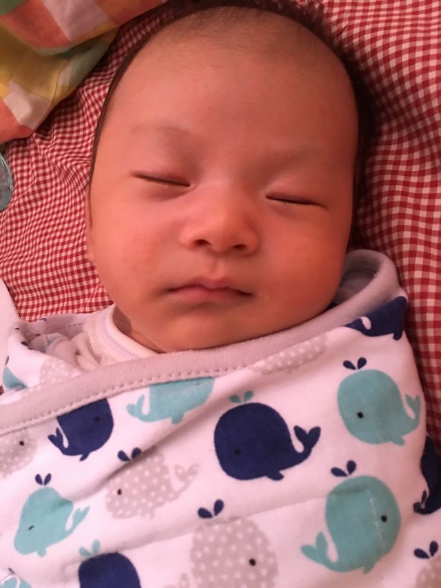 冷氣開涼一點臉上就消不少掉了，有想過給他穿紗布衣就好，但是他會一直驚嚇 手一直揮，所以包巾只好在他睡覺時抱著。 感覺好像是包巾包住太熱了